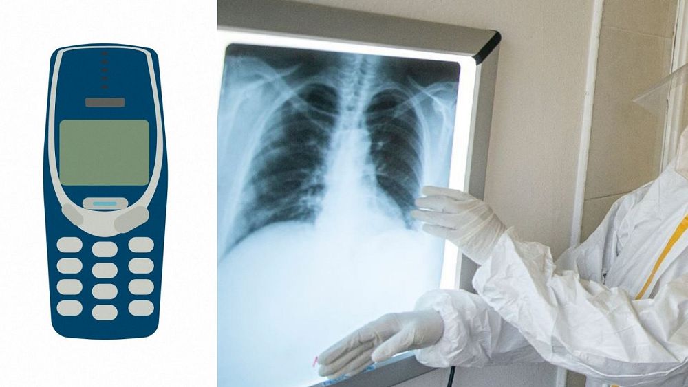 Prisoner in Kosovo puts bile in mobile as Nokia is found in stomach - NewsOpener Prisoner in Kosovo puts bile in mobile as Nokia is found in stomach
