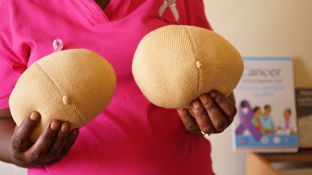 Ouganda : des survivantes du cancer du sein fabriquent des prothèses