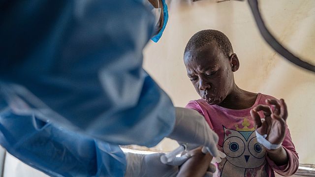 Mpox outbreak hits Kabare amid ongoing conflict in DRC thumbnail