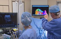 La tecnología 3D, un nuevo apoyo para los cirujanos