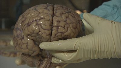 Deep inside the brain Deep inside the brain