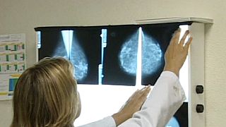 Megható felvétel egy mellrákos beteg küzdelméről