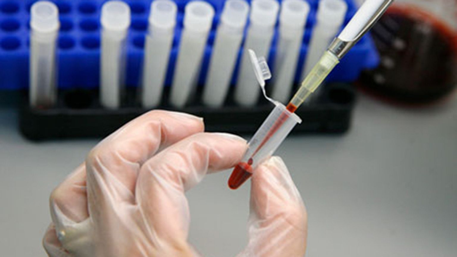 Βραζιλία: Στα φαρμακεία θα πωλείται το τεστ για HIV