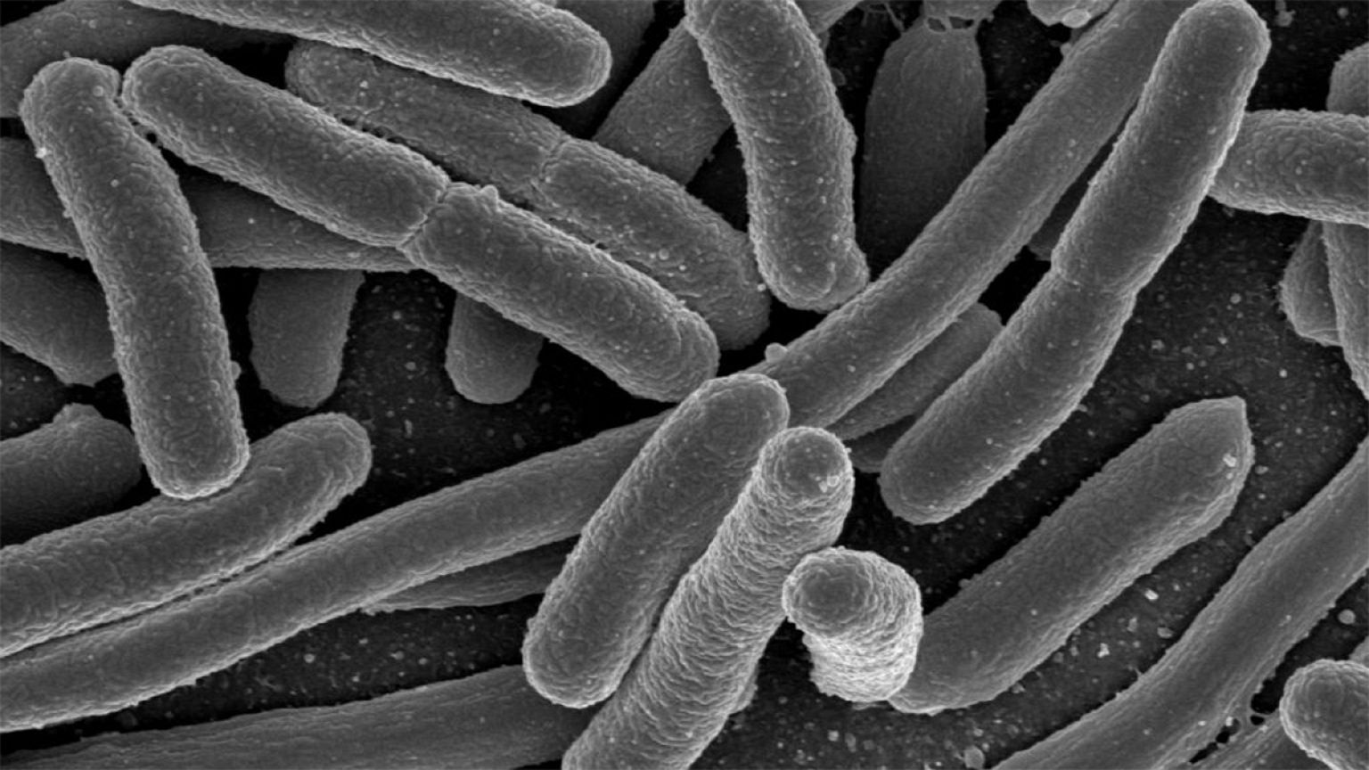 Une bactérie inconnue en cause dans les décès de trois nouveaux-nés en France