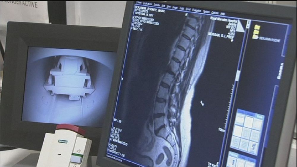 New MRI scan redefining myeloma treatment | Euronews