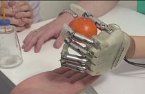 Amputee recovers feeling with robotic arm