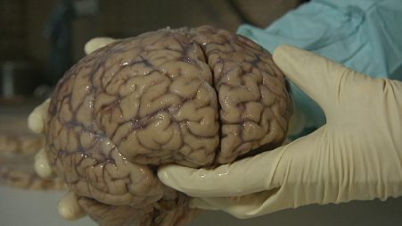 Do you know: do injured brains dream?