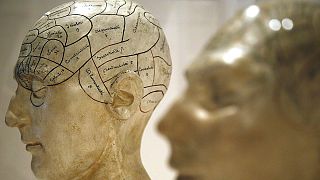 Scientists find brain's weak spot for dementia and schizophrenia
