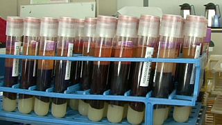 US ban on gay blood donations to be changed