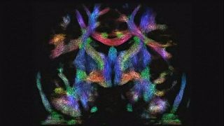 Προγεννητική μαγνητική τομογραφία για τον εγκέφαλο
