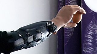 Austrian men become first in the world to have bionic hands