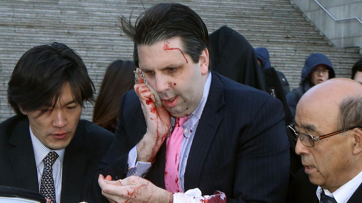 السفير الأمريكي في سيول يجري عملية جراحية ناجحة إثر تعرضه لهجوم
