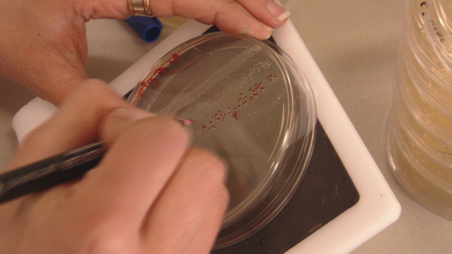 Resistance movement: the battle to beat the antibiotic-proof superbug