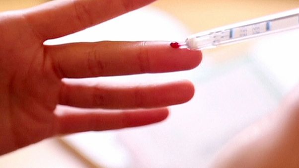 Аналіз на ВІЛ-інфекцію можна зробити вдома Аналіз на ВІЛ-інфекцію можна зробити вдома