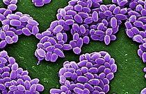 Le Pentagone envoie des bacilles d'anthrax jusqu'en Australie