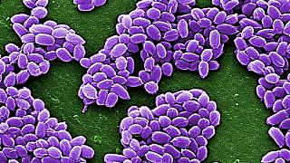 US-Labor verschickte mehr lebende Anthrax-Proben als bisher bekannt