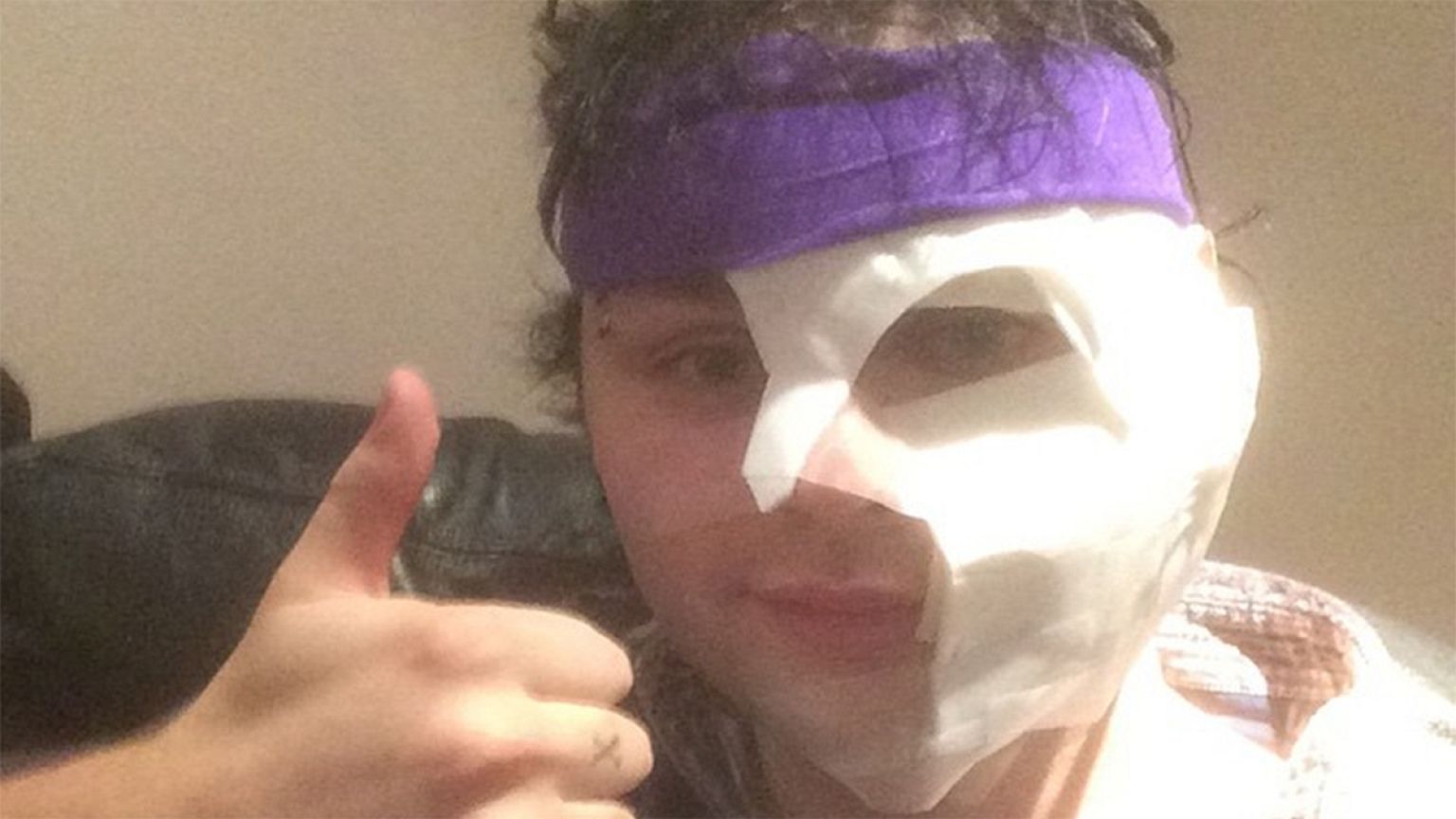 Guitarist burns face after walking into fireworks display