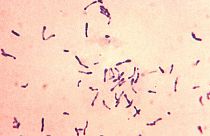 Tod durch Diphterie: Nicht geimpfter Junge in Spanien gestorben