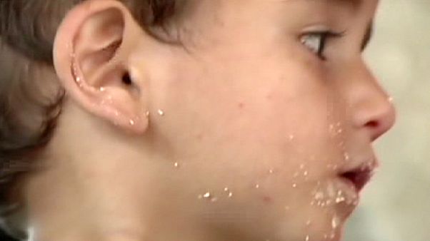 Les enfants de Gaza se remettent du conflit, dans la douleur Les enfants de Gaza se remettent du conflit, dans la douleur