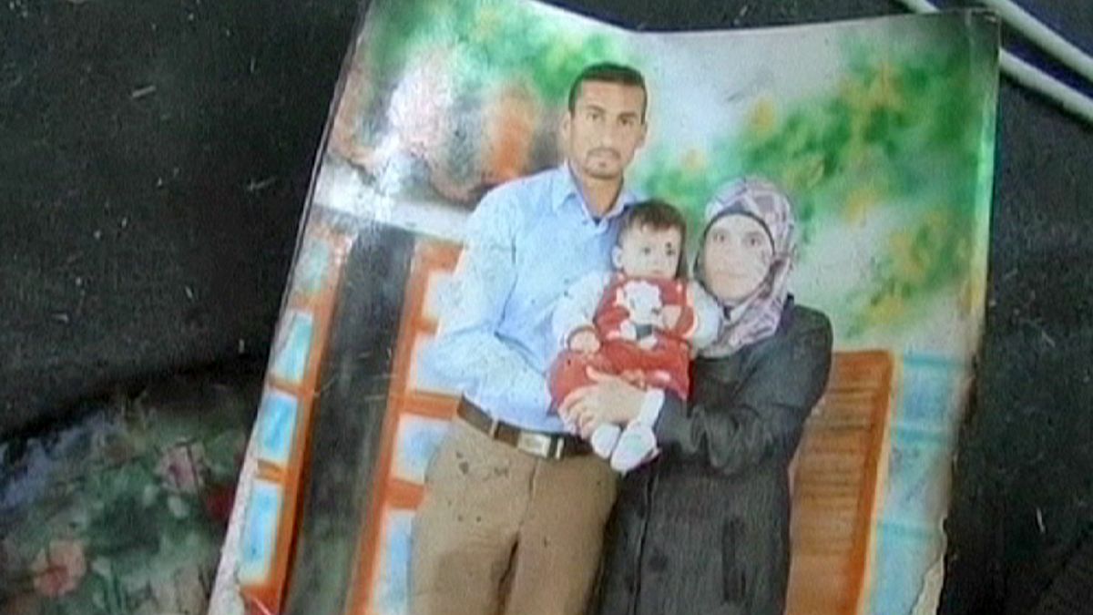 پس از کودک هجده ماهه فلسطینی پدر نیز بر اثر آتش سوزی عمدی درگذشت