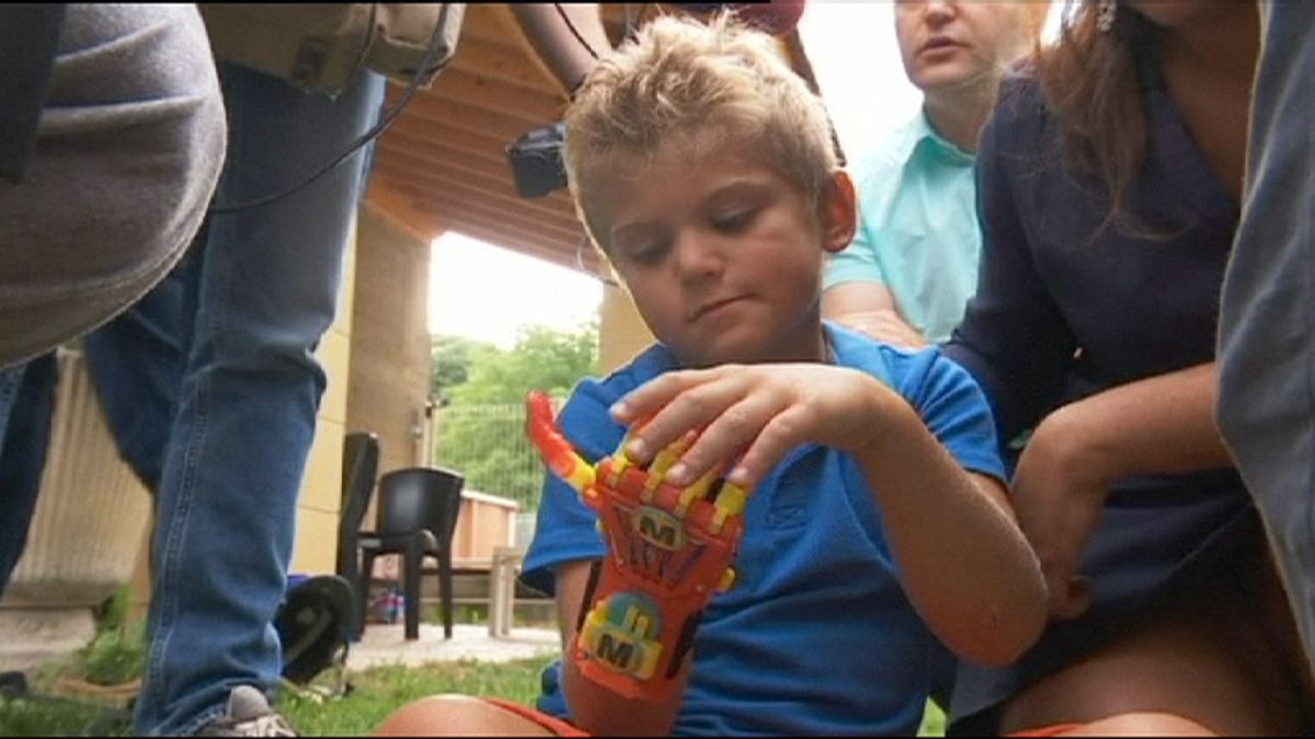 French boy, 6, first to receive 3D-printed prosthetic limb