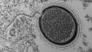 Descubren un nuevo virus gigante venido del hielo con 30.000 años de edad