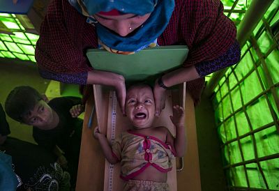 A Rohingya refugee is measured at a malnutrition center in Balukhali camp on Jan. 13, 2018 in Cox\'s Bazar, Bangladesh.