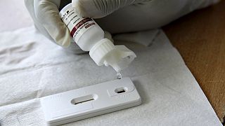 Όλοι οι φορείς του ιού HIV πρέπει να λαμβάνουν αντιρετροϊκά φάρμακα