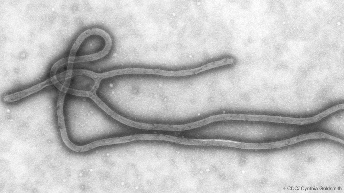 Ebola-Virus überlebt bis zu neun Monate in Sperma