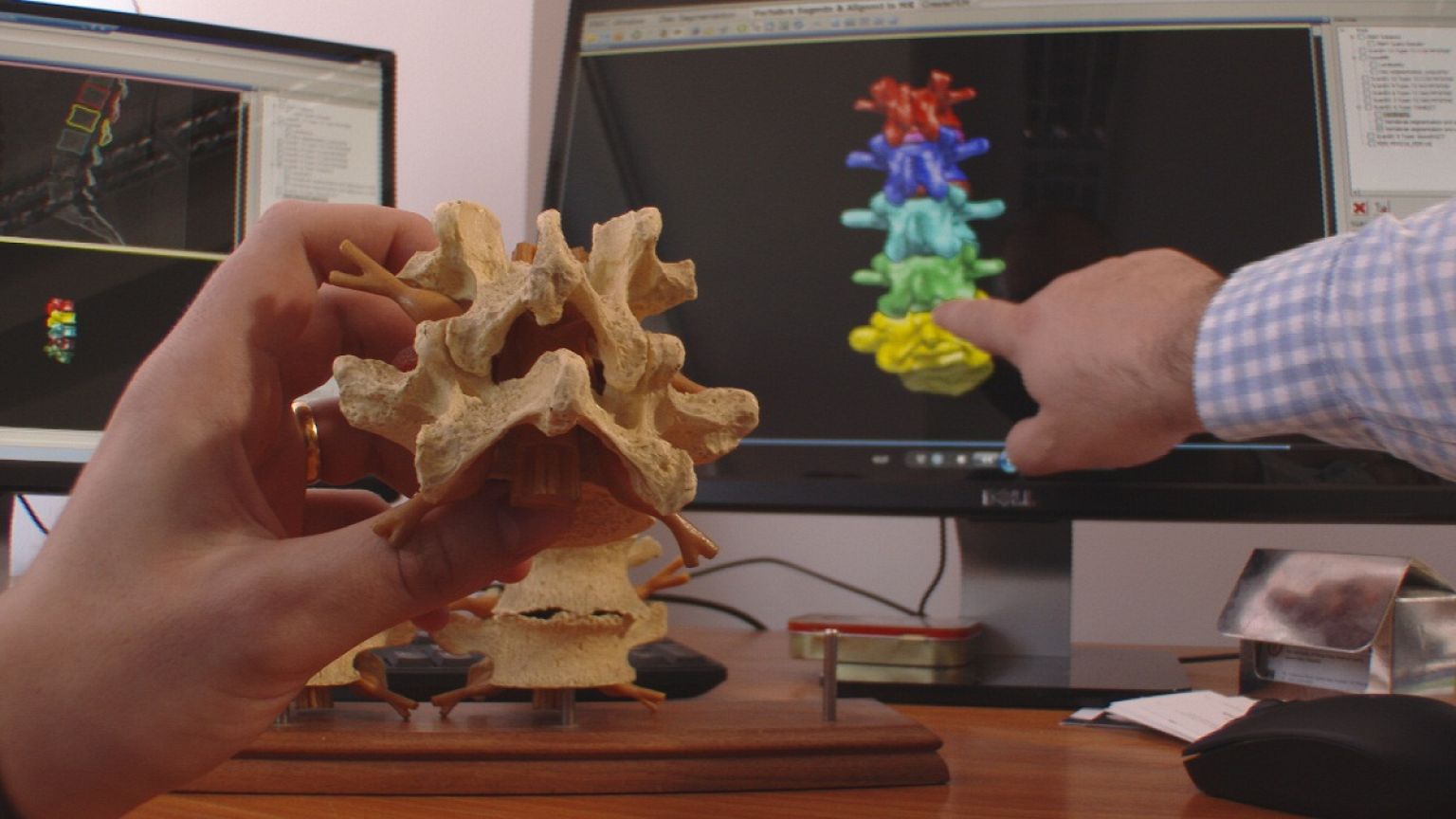 Do you know: can computers heal spines?