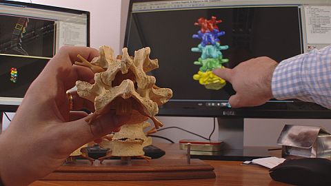Do you know: can computers heal spines?