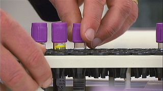 Un nouveau test pour mieux dépister le cancer de la prostate Un nouveau test pour mieux dépister le cancer de la prostate