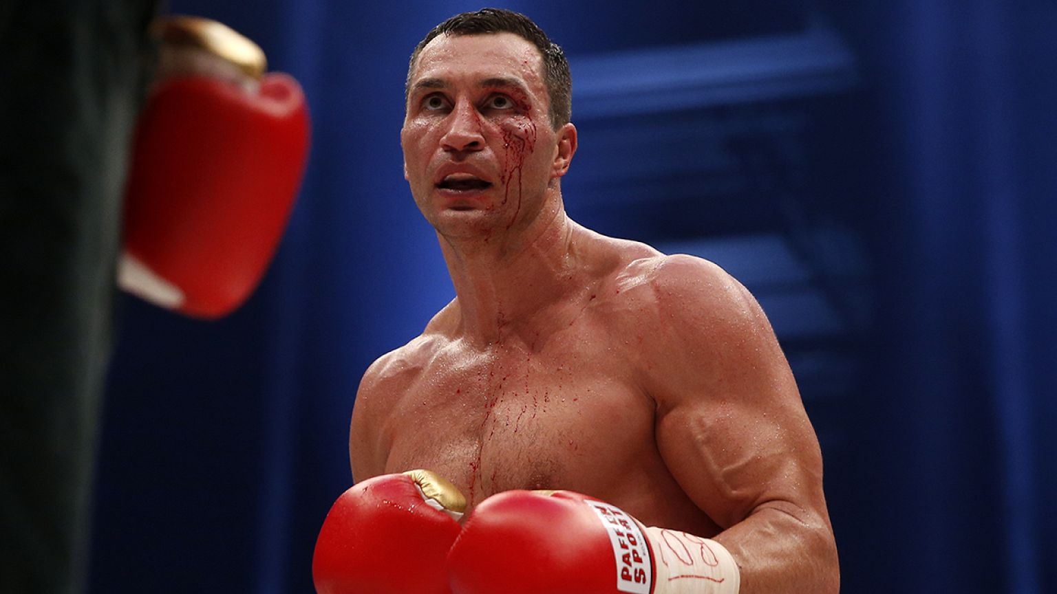 #KlitschkoFury: Zwischen Trost und Häme
