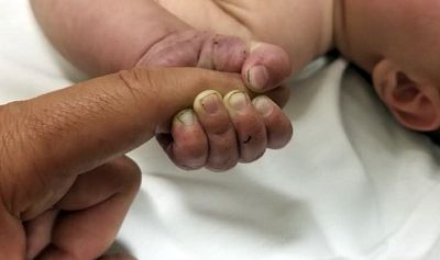 A 5-month-old infant with dirt under their fingernails after authorities say the baby survived hours being buried under sticks and debris in the woods on July 8, 2018.