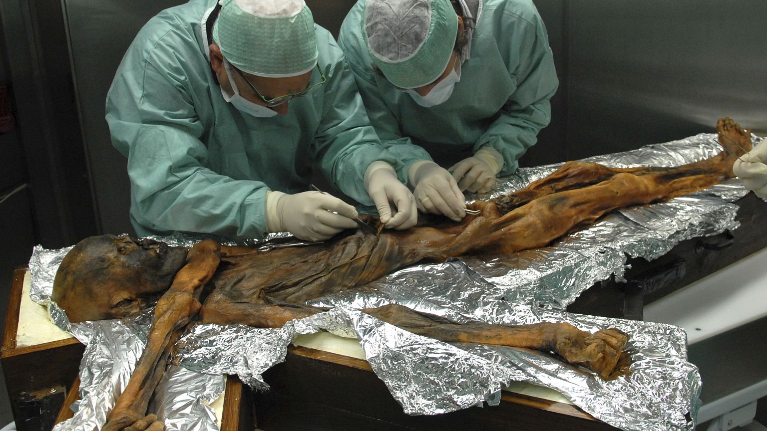 Image: Oetzi the Iceman