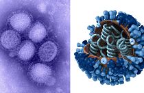 Растет число погибших от осложнений, вызванных "свиным гриппом"