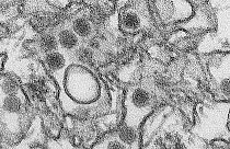 ¿Qué es el virus Zika?