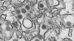 Informationen zum Zika-Virus