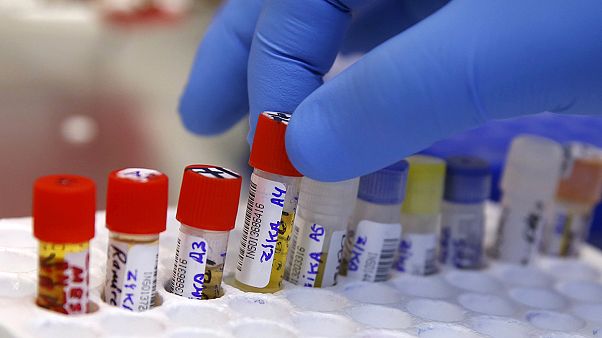 Virus Zyka: è ufficiale. La malattia si trasmette anche sessualmente Virus Zyka: è ufficiale. La malattia si trasmette anche sessualmente