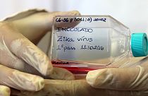 Científicos eslovenos prueban la relación entre el virus del Zika y la microcefalia