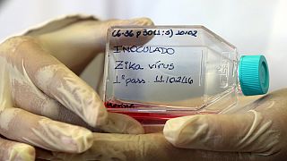 Slovenian researchers find brain link for Zika virus