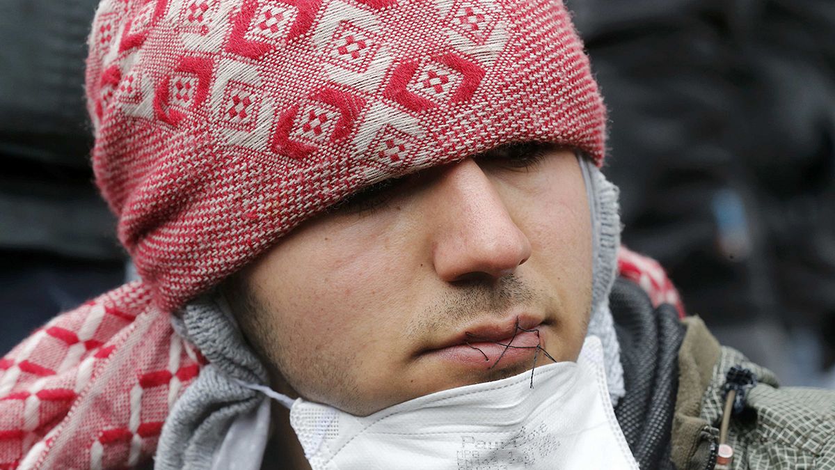Migrants sew lips together to protest treatment in Calais Jungle