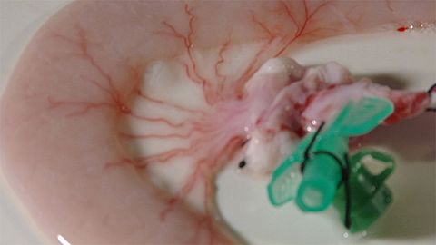 Takeaway: growing bones