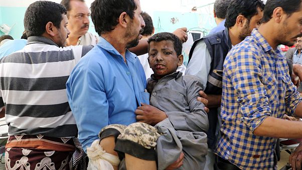 Image: A Yemeni man holds a boy who was injured by an airstrike in Saada Image: A Yemeni man holds a boy who was injured by an airstrike in Saada