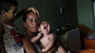 Brazil strengthens healthcare to tackle microcephaly