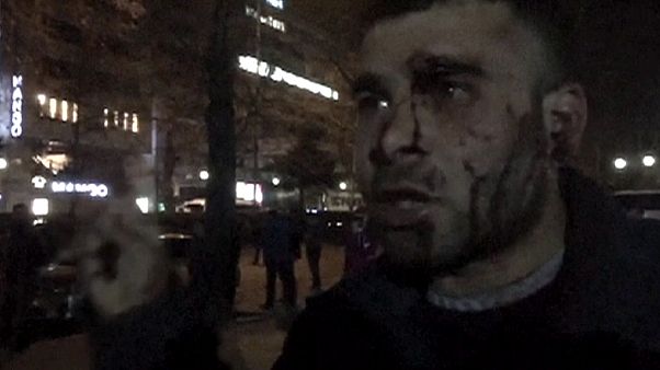Ankara, la testimonianza dei sopravvissuti all'attentato Ankara, la testimonianza dei sopravvissuti all'attentato