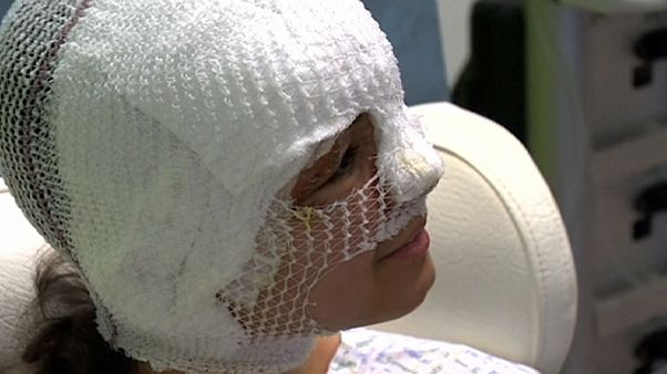 Fanny, herida en el atentado del aeropuerto de Bruselas: "No me paso el día llorando porque me iba a deshidratar" Fanny, herida en el atentado del aeropuerto de Bruselas: "No me paso el día llorando porque me iba a deshidratar"
