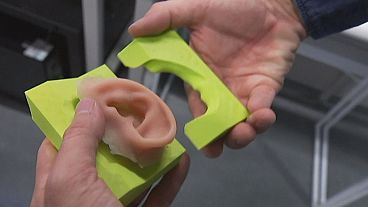 Girl to be fitted with 3D printed ear in Australia