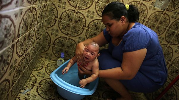 La OMS considera que los Juegos no alteran la propagación del Zika La OMS considera que los Juegos no alteran la propagación del Zika