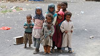 Yemen'de çocuk olmak!